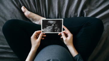 A pregnant woman holding a picture of a sonogram.