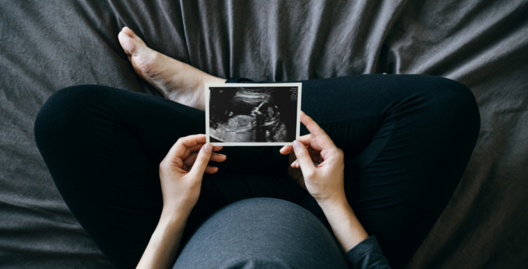 A pregnant woman holding a picture of a sonogram.